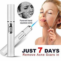 Revitalize Your Skin with the Blue Light Therapy Acne Laser Pen – Effective Soft Scar & Wrinkle Removal Treatment