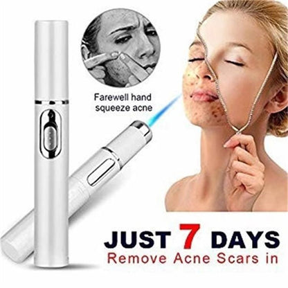 Revitalize Your Skin with the Blue Light Therapy Acne Laser Pen – Effective Soft Scar & Wrinkle Removal Treatment