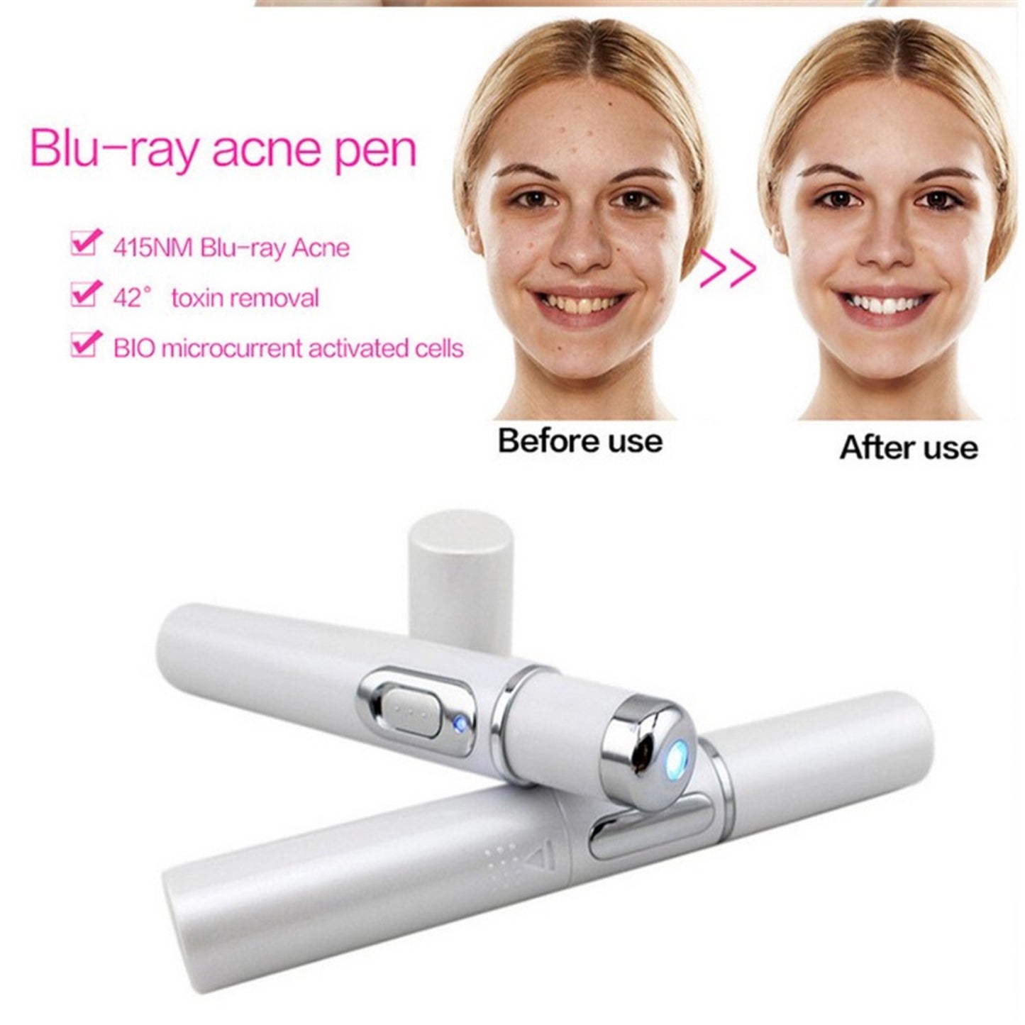 Revitalize Your Skin with the Blue Light Therapy Acne Laser Pen – Effective Soft Scar & Wrinkle Removal Treatment