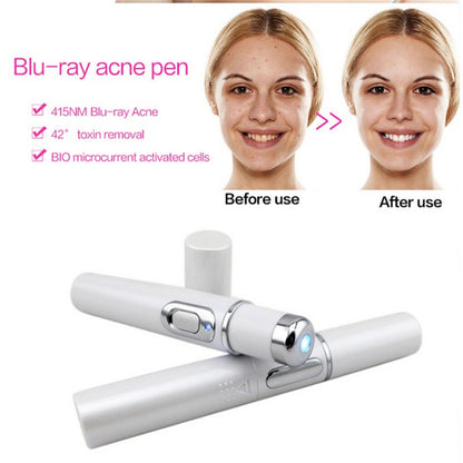 Revitalize Your Skin with the Blue Light Therapy Acne Laser Pen – Effective Soft Scar & Wrinkle Removal Treatment