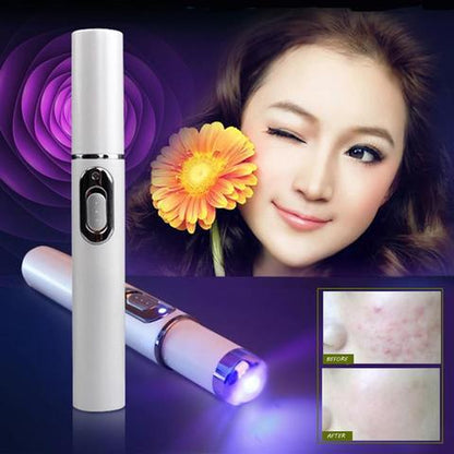 Revitalize Your Skin with the Blue Light Therapy Acne Laser Pen – Effective Soft Scar & Wrinkle Removal Treatment