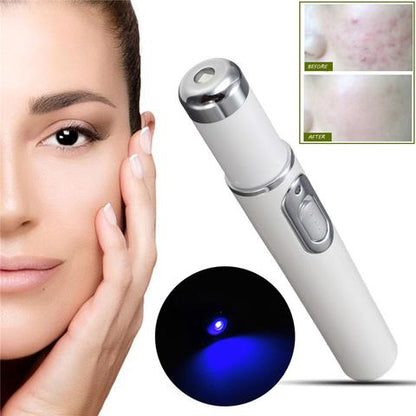 Revitalize Your Skin with the Blue Light Therapy Acne Laser Pen – Effective Soft Scar & Wrinkle Removal Treatment